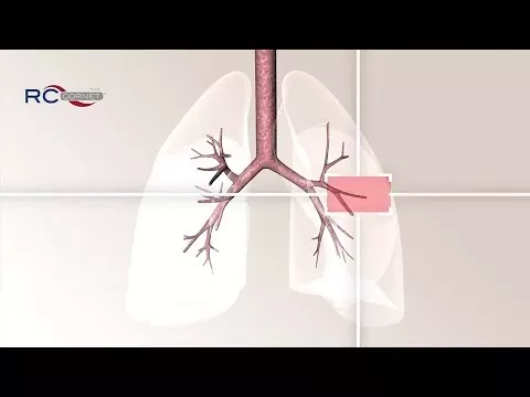 Video o proizvodu RC Kornet Plus, 1 kom