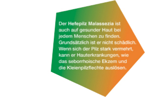 KETOZOLIN 2% šampon, 120 ml