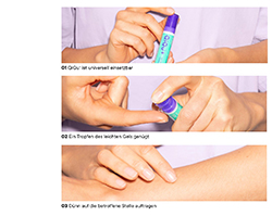 QIQU SOS Gel za obnavljanje kože, 2X5 ml