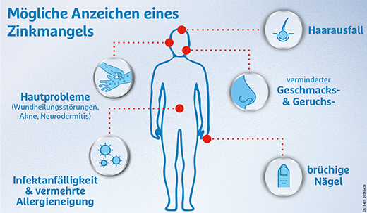 ZINKOROT 25 mg tablete, 100 kom