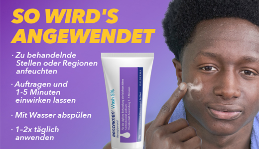 BENZAKNEN Ispiranje 5% suspenzije, 2X100 g