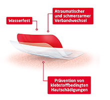 LEUKOMED T plus skin sensitive sterilni 8x10 cm, 5 kom