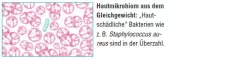 Instructions for use for AKTIVADERM ND Tretman kože neurodermitisa aktivni probiotici, 125 g - 2